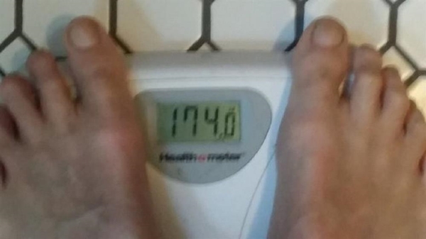 Foto - Her gün 10 kutu kola içti ve bakın ne oldu