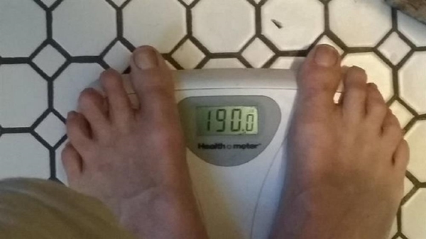 Foto - Her gün 10 kutu kola içti ve bakın ne oldu