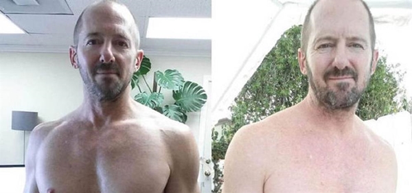 Foto - Her gün 10 kutu kola içti ve bakın ne oldu