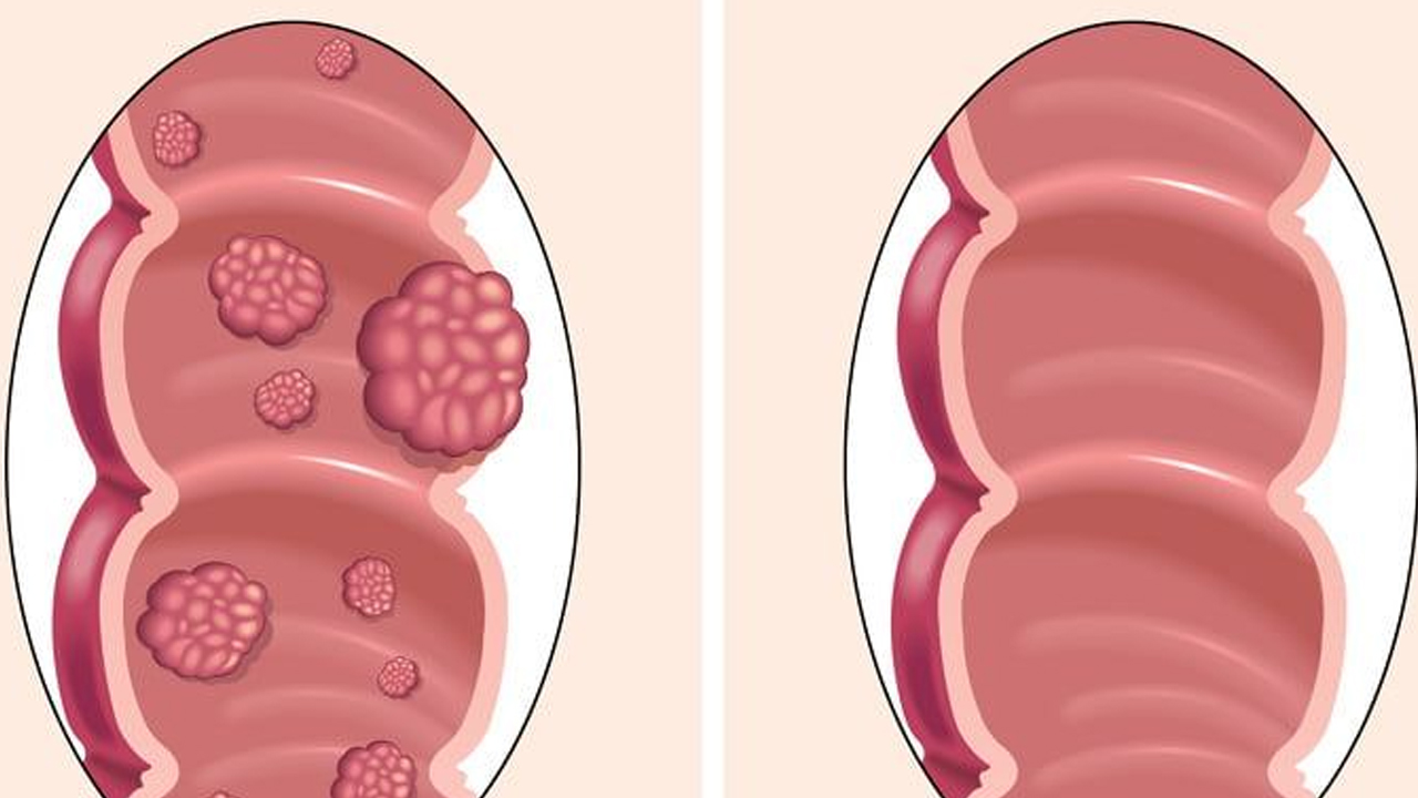 Foto - Her gün 3 hurma yiyenin başına bunlar geliyor: Öyle bir şey ki zarar vermiyor! Bunu yaparsanız bakın ne olacak