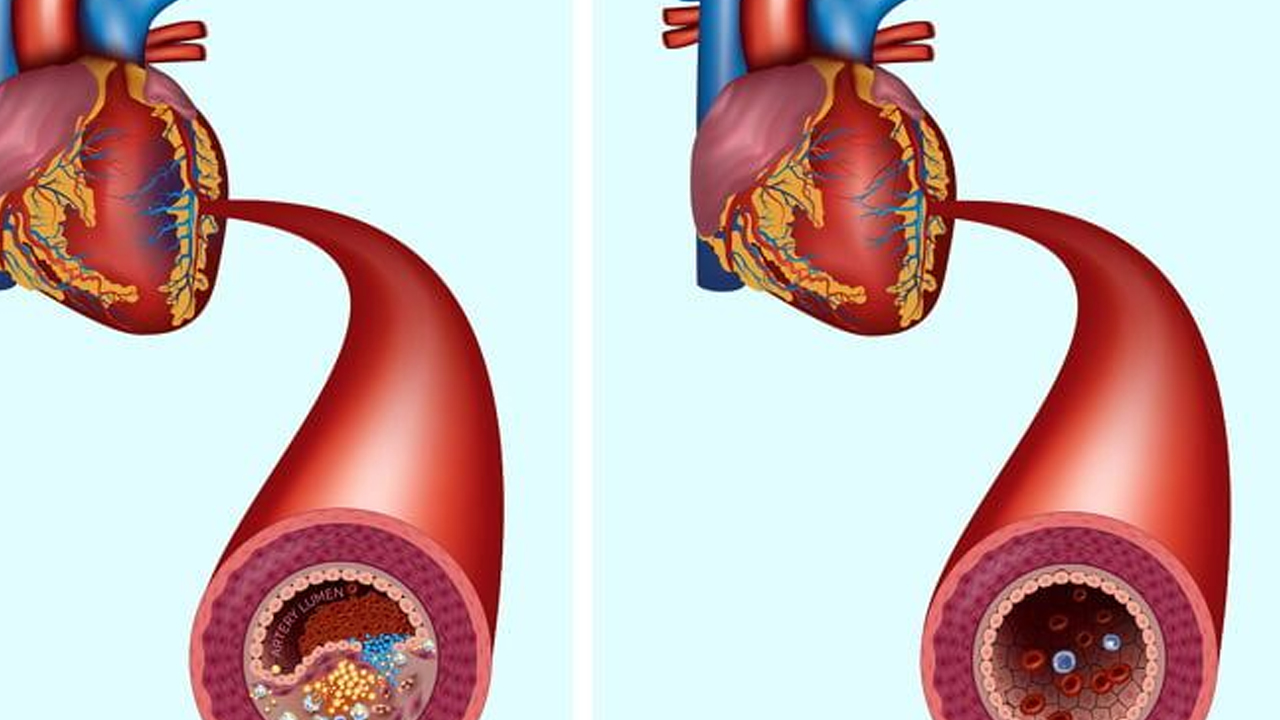 Foto - Her gün 3 hurma yiyenin başına bunlar geliyor: Öyle bir şey ki zarar vermiyor! Bunu yaparsanız bakın ne olacak