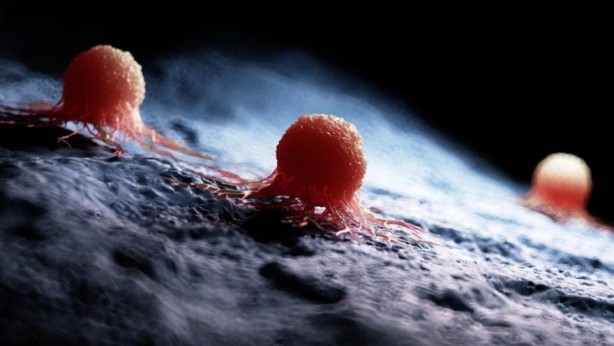 Her gün tüketilen ve kanser riskini artıran 3 içecek