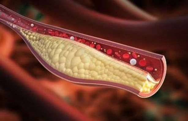 Foto - Her gün tüketsek de bilmiyoruz! Uzman yorumuyla her derde deva denilen 6 besin