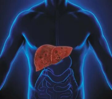 Foto - Her sabah kahvaltıda yedi, karaciğerini yok etti! Önce elleri kaşındı sonrasında...