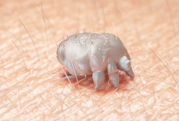 Foto - Her yıl 100 milyon kişiyi etkiliyor! Bu belirtiler varsa vakit kaybetmeyin