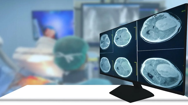 Foto - Herkes şaşkın! İlk kez beyin bedenden bağımsız canlı kaldı ama... 