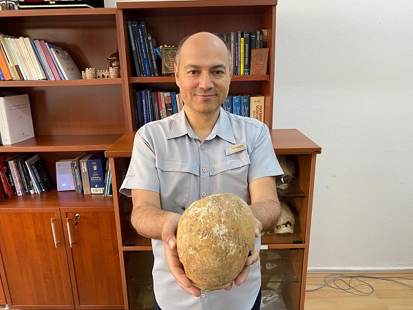 Foto - Herkes şaşkın! Türkiye'de ilk kez böyle bir şeye rastlandı