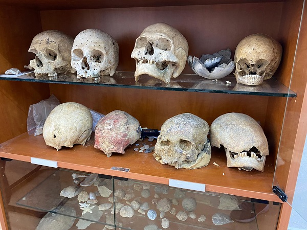 Foto - Herkes şaşkın! Türkiye'de ilk kez böyle bir şeye rastlandı