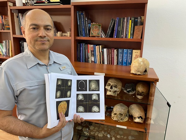 Foto - Herkes şaşkın! Türkiye'de ilk kez böyle bir şeye rastlandı