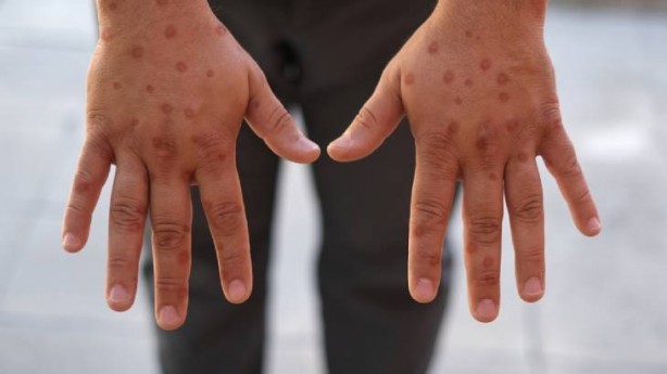 Foto - Herkes Simpsonlar diyordu ama Yusuf Güney'in son tahmini korkuttu: Buna dikkat edin, çok kişi ölecek