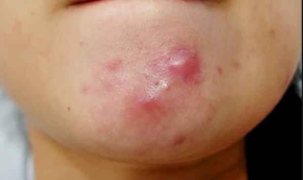 Foto - Herkes tüketiyor! Karpuz çekirdeğini yemek sağlıklı mı? İşte cevabı...