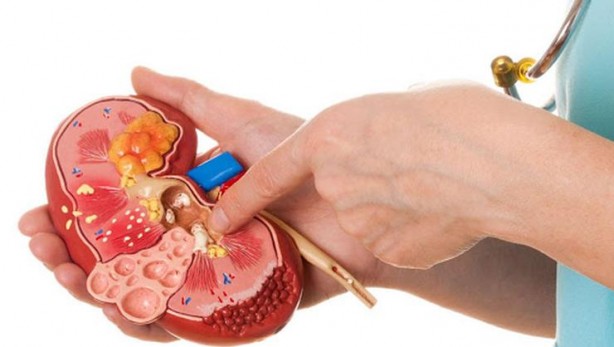 Foto - Türk profesörden hayati uyarı! Su içmezseniz...