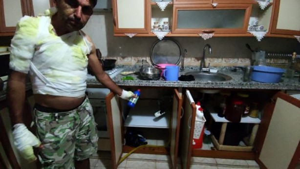 Foto - Herkesin evinde bulunuyor! Ölümden döndüren kaza