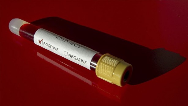 Foto - Heyecan verici gelişmeyi dünyaya duyurdular: Koronavirüsü yendik