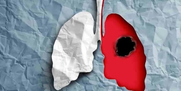 Foto - Hibiskus ve faydaları! İbrahim Saraçoğlu öneriyor: Hastalığın ilacı bu ünlü çay ilgi çekiyor... Şifası var