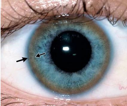 Foto - Hibiskus ve faydaları! İbrahim Saraçoğlu öneriyor: Hastalığın ilacı bu ünlü çay ilgi çekiyor... Şifası var