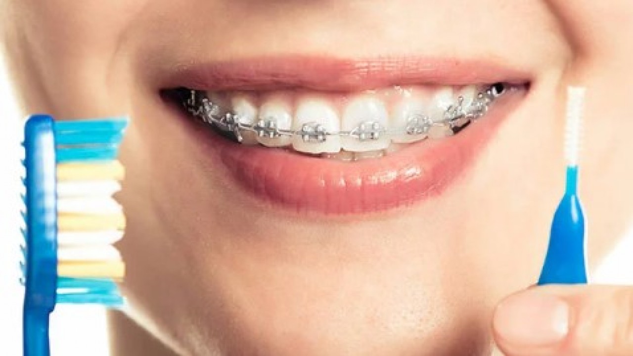 Foto - Bunu çok az kişi biliyor: Diş fırçasının arka tarafı bakı ne işe yarıyor!