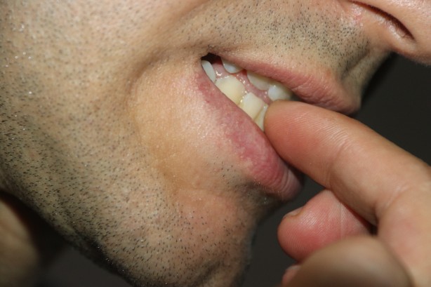 Hiç kimsenin aklına bile gelmez! Tırnak yeme alışkanlığının sebebi bakın neymiş