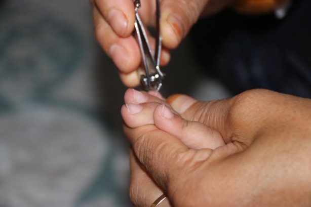 Foto - Hiç kimsenin aklına bile gelmez! Tırnak yeme alışkanlığının sebebi bakın neymiş