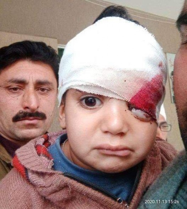 Foto - Hindistan sivilleri katlediyor! Pakistan Keşmir için savaşa girdi