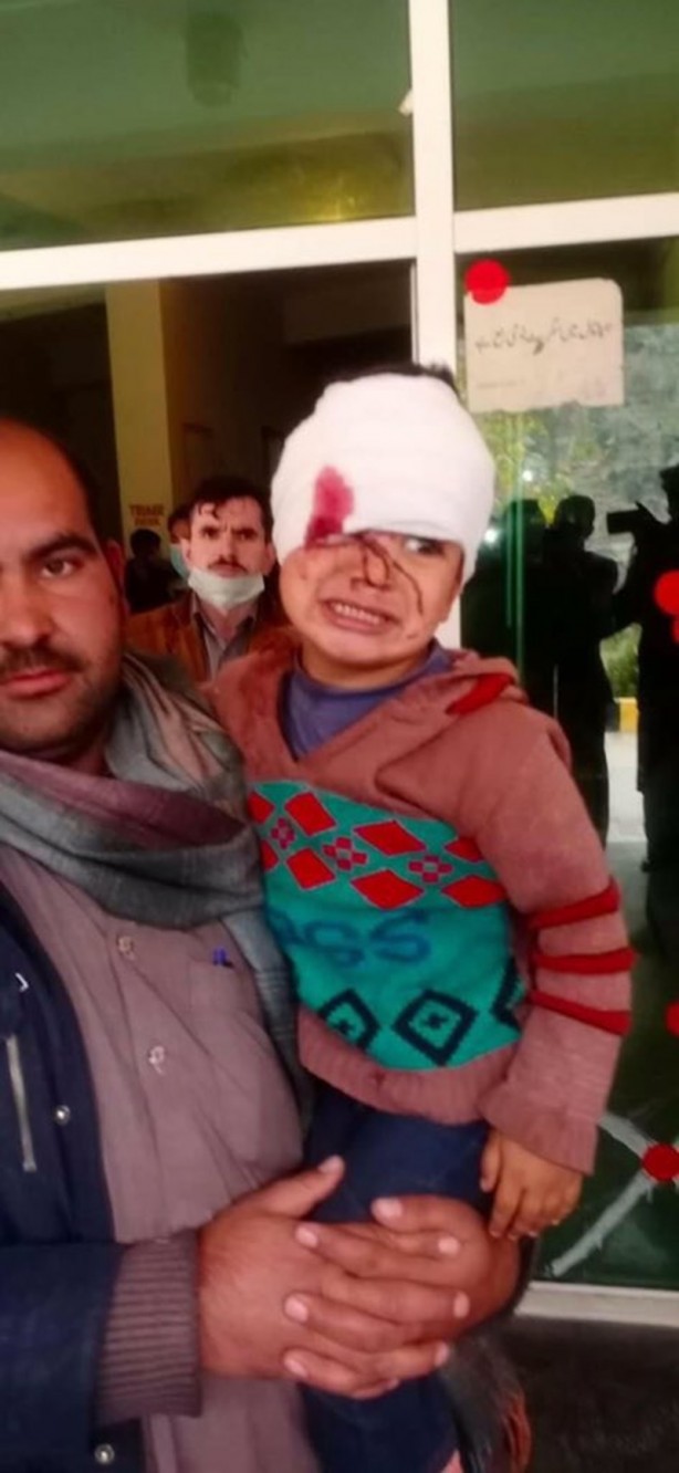 Foto - Hindistan sivilleri katlediyor! Pakistan Keşmir için savaşa girdi