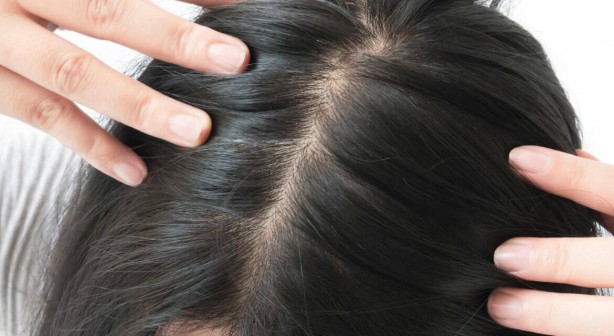 Foto - Hint yağının bu faydalarını duyunca evinizden eksik etmeyeceksiniz! 