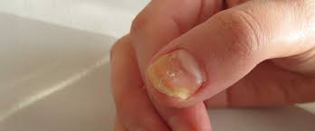 Foto - Hint yağının bu faydalarını duyunca evinizden eksik etmeyeceksiniz! 