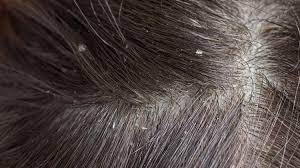 Foto - Hint yağının bu faydalarını duyunca evinizden eksik etmeyeceksiniz! 