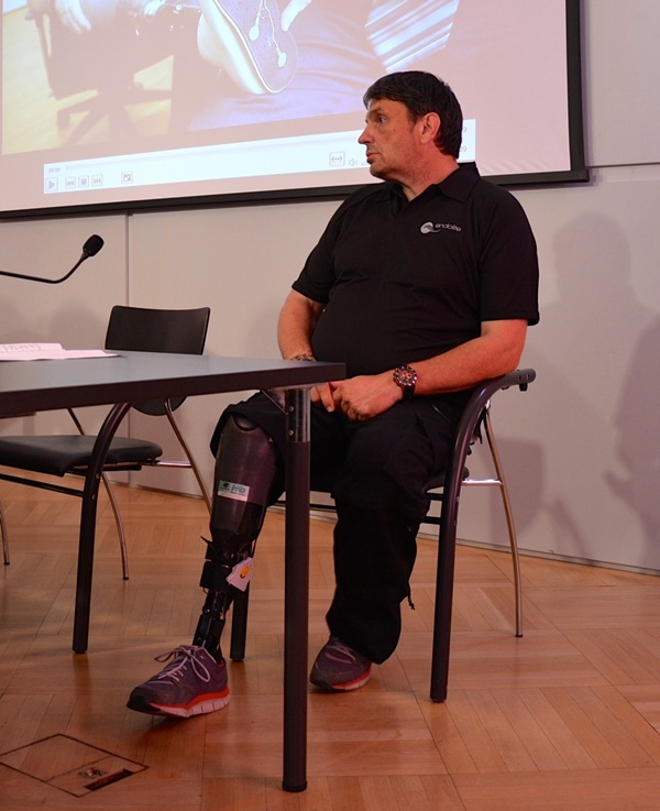 Foto - Hisseden protez bacak geliştirildi