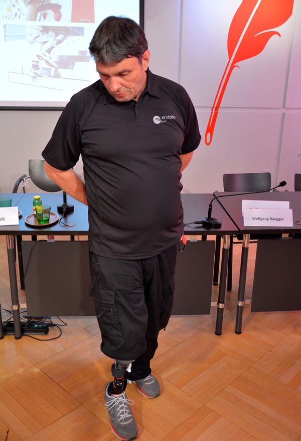 Foto - Hisseden protez bacak geliştirildi