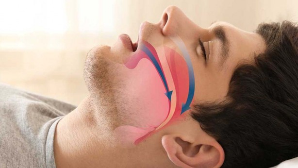 Foto - Horlama neden olur? Horlamaya en etkili 10 çözüm!