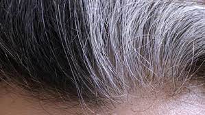 Foto - Hurma çekirdeğini atmayın: Çünkü müthiş bir faydası bulundu, duyan şaşırdı! Hurmaya dair bilinmeyenler