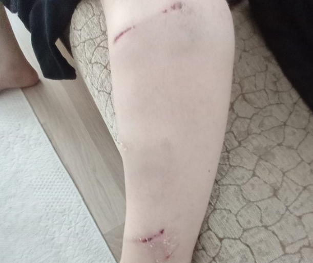 Foto - İBB Başkan Danışmanı Murat Ongun'un köpeği, belediye çalışanını yaraladı! Şikayetçi olan işçi, işten kovuldu