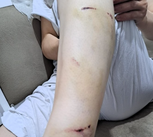 Foto - İBB Başkan Danışmanı Murat Ongun'un köpeği, belediye çalışanını yaraladı! Şikayetçi olan işçi, işten kovuldu
