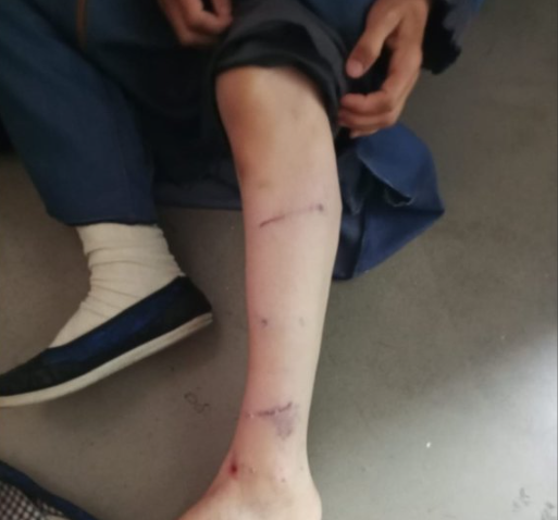 Foto - İBB Başkan Danışmanı Murat Ongun'un köpeği, belediye çalışanını yaraladı! Şikayetçi olan işçi, işten kovuldu