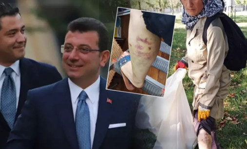 Foto - İBB Başkan Danışmanı Murat Ongun'un köpeği, belediye çalışanını yaraladı! Şikayetçi olan işçi, işten kovuldu