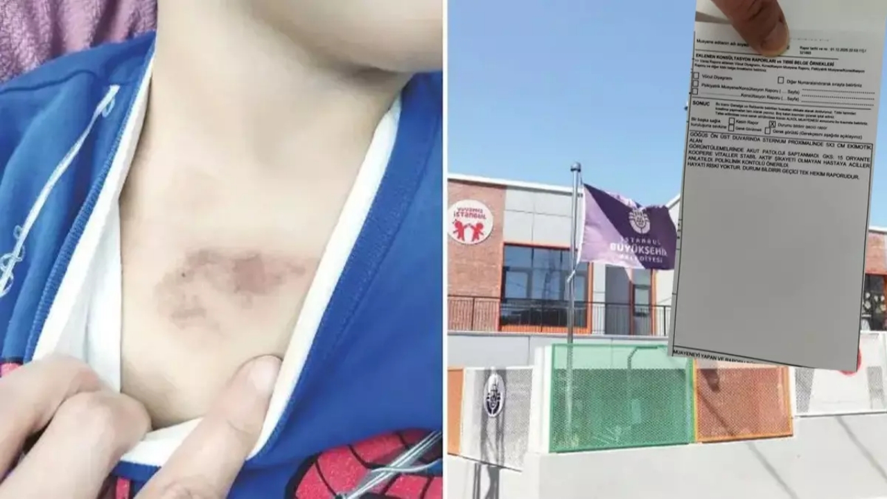 İBB’deki kreş rezilliğinde mağdur çocuğun ifadesi ortaya çıktı: Çıplakken kameraya çekmişler