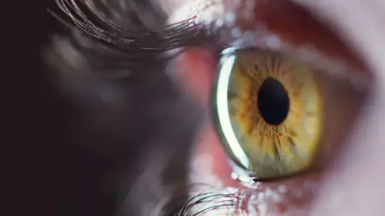 İbn-i Sina 1000 yıl önce önerdi! Tepsiye koyup sadece 5 dakika ile net sonuçlar alın...