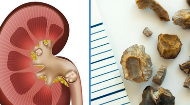 Foto - İbn-i Sina bin yıl önce sağlıklı yaşamanın şifresini vermiş! İşte yapmanız gerekenler ve her şey