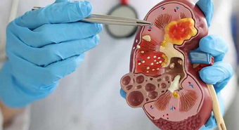 Foto - İbn-i Sina bin yıl önce sağlıklı yaşamanın şifresini vermiş! İşte yapmanız gerekenler ve her şey