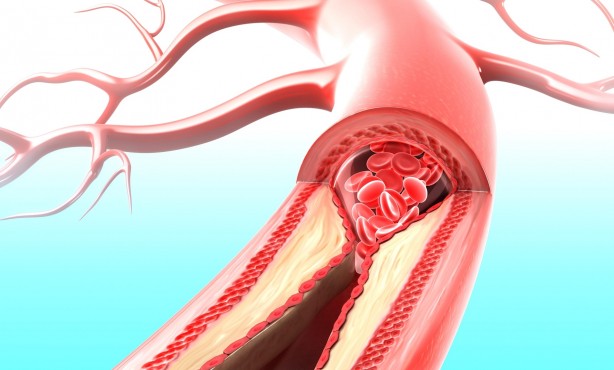 Foto - İbn-i Sina bin yıl önceden uyardı! Sporun en dengelisi…