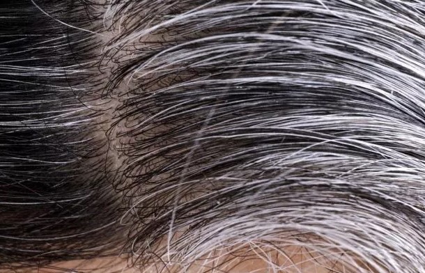 Foto - İbn-i Sina'dan beyaz saçlar için binlerce yıllık reçete!