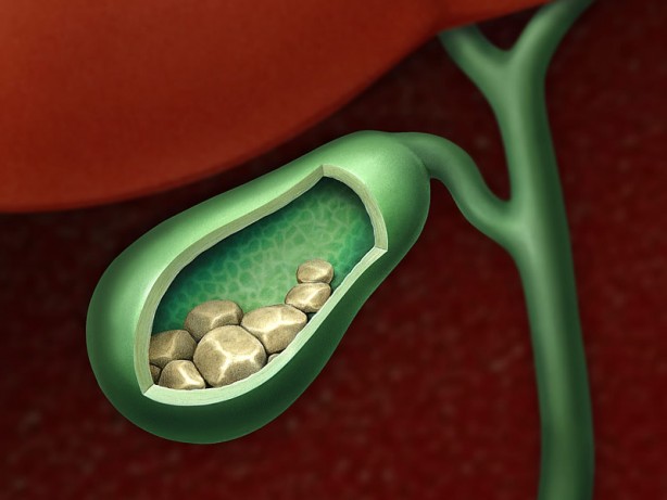 Foto - İbn-i Sina’nın yıllar önce yazdığı şifa Soğanı balla karıştırıp yerseniz bakın ne olur