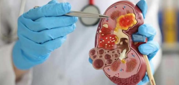 Foto - İbni Sina 1000 yıl önce yazmış: Bunlar süper gıda diye olay bir mesaj verdi! Şok olacaksınız