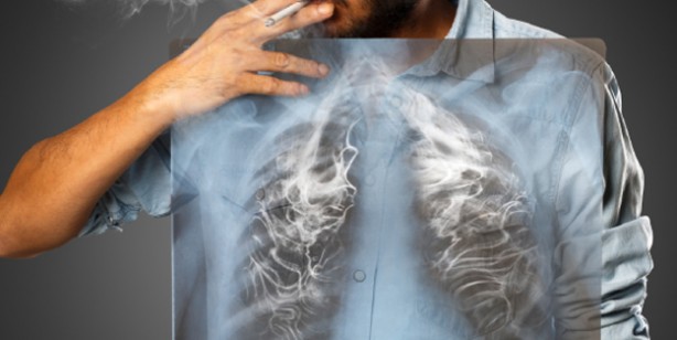 Foto - İbrahim Saraçoğlu akciğer kanseri kür tarifleri: Tere kürü, zencefilli kür akciğerleri temizliyor, kanserden koruyor!