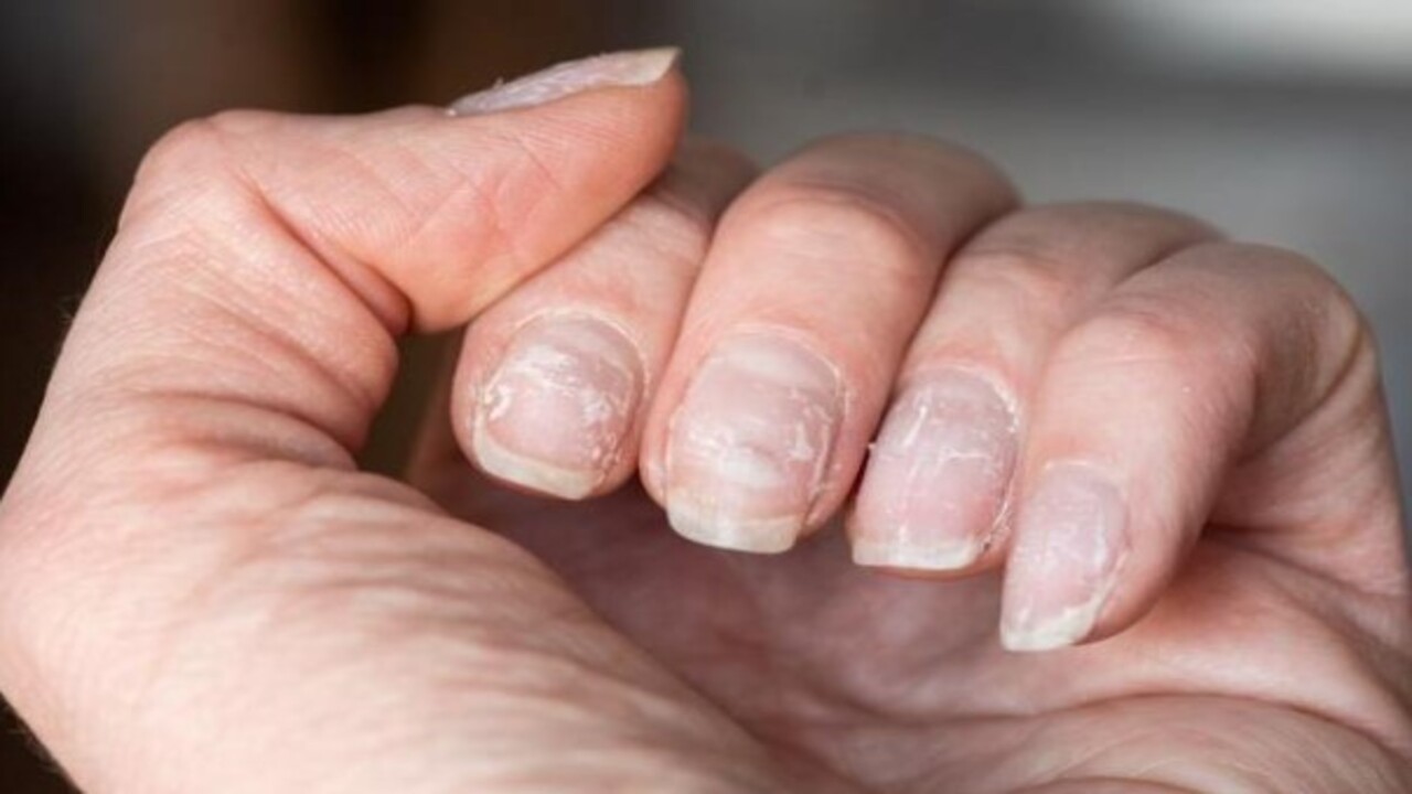 Foto - İç organlara yayılma riski var! Tırnak üzerindeki bu leke neyin habercisi