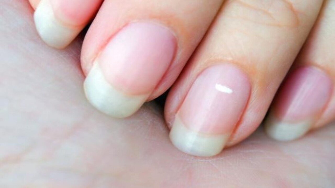 Foto - İç organlara yayılma riski var! Tırnak üzerindeki bu leke neyin habercisi