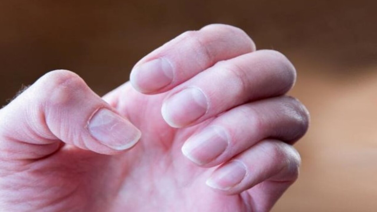 Foto - İç organlara yayılma riski var! Tırnak üzerindeki bu leke neyin habercisi