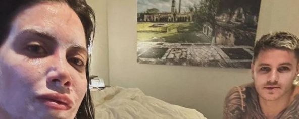 Icardi çıldırdı! Artık samimiyetsizlik her yerden fışkırıyor! Hani sakattı bu adam!