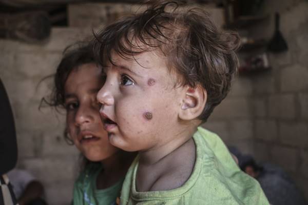 Foto - İdlib'de büyük tehlike! "Durum içler acısı"